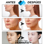 Tiras Lifting Facial