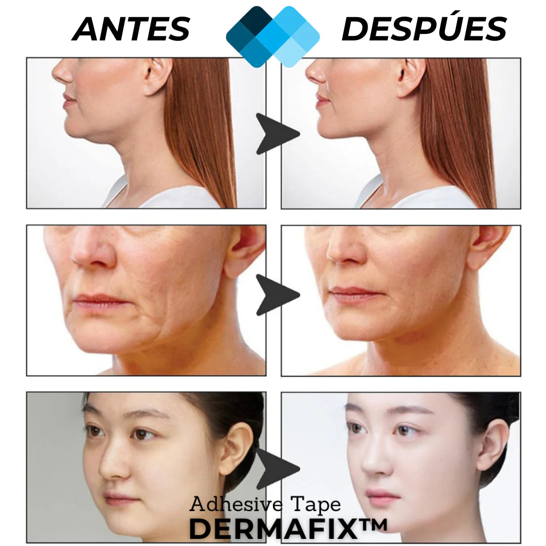 Tiras Lifting Facial